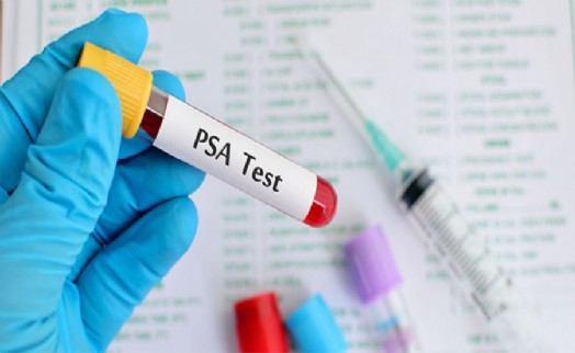 PROSTAT KANSERİ HER 12 ERKEKTEN 1'İNİ ETKİLİYOR
